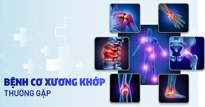 bệnh lý xương khớp