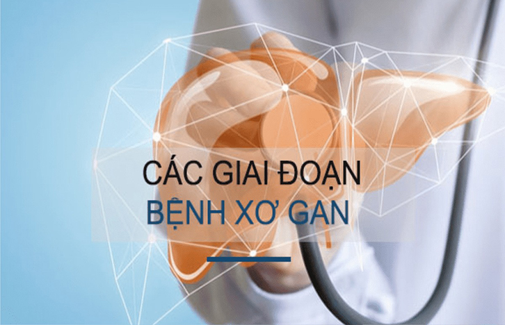 bệnh xơ gan