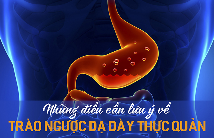 trào ngược dạ dày thực quản