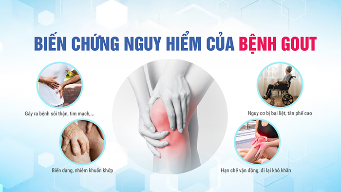 biến chứng bệnh gout