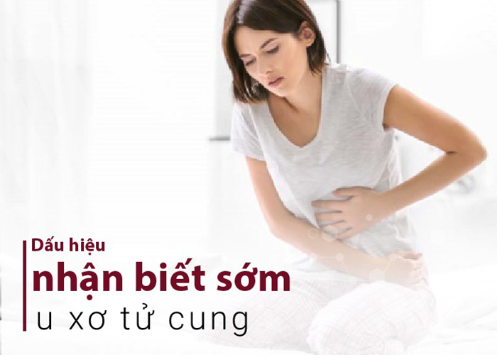 Dấu hiệu bệnh lý u xơ tử cung 